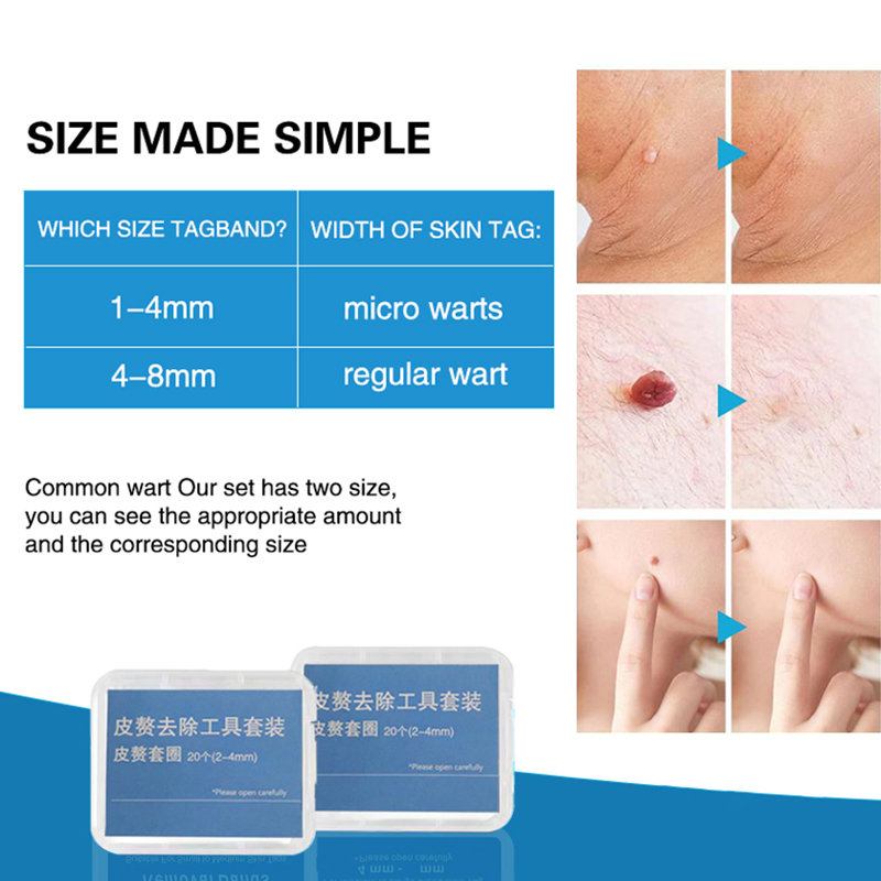20pcs/Box Flesh Nevus Removal  - đánh giá và giá Power Tools Kit Set